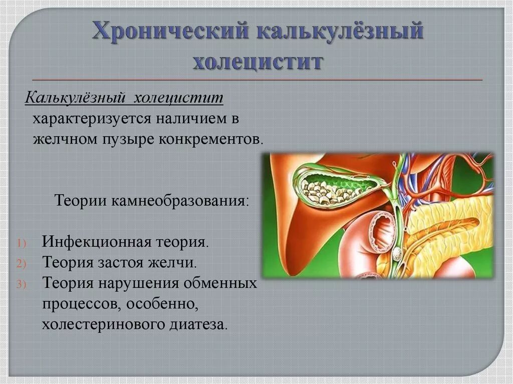 Жкб острый. ЖКБ калькулезный холецистит классификация. ЖКБ хронический калькулезный холецистит. Калькулезный желчный пузырь что такое. ЖКБ острый калькулезный холецистит УЗИ.