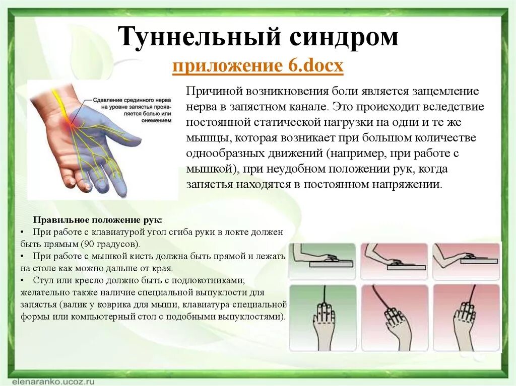 Как лечить запястный синдром. Запястный синдром синдром запястного канала. туннельный синдром (синдром запястного канала). туннельный синдром запястья кисти. туннельный синдром запястья лекарства.