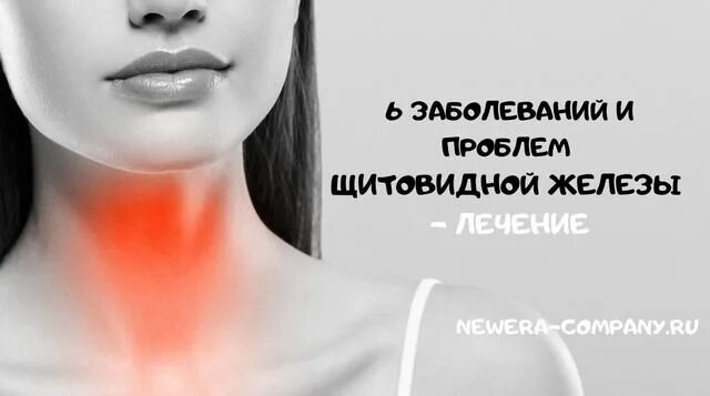 Проблемы с щитовидной симптомы у мужчин. Проблемы с щитовидной железой. Проблемы с щитовидкой симптомы. Проблемы с щитовидкой симптомы у женщин.