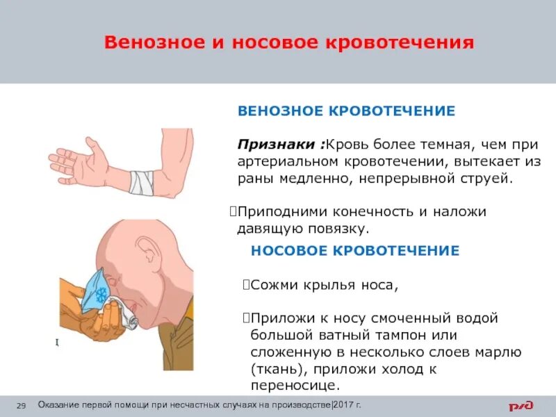 Кровотечение какие симптомы. Венозная симптомы и первая помощь. Венозное кровотечение (признаки, ПМП). Признаки виновного кровотечения. При венозном кровотечении кровь вытекает.