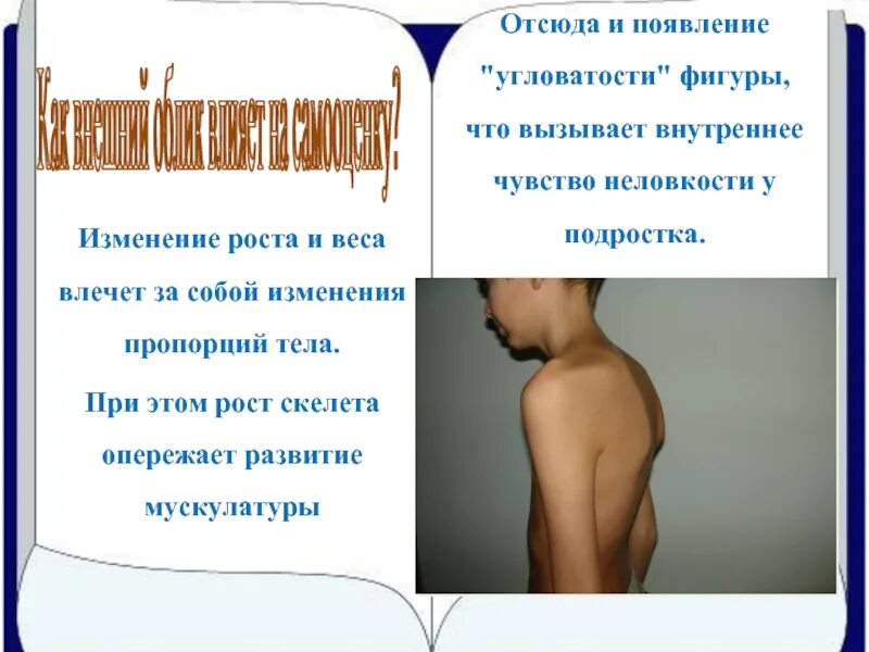 Физическое изменение подростков. Физические изменения у подростков. Изменение роста. Угловатость. Подростковые физические изменения у подростков.