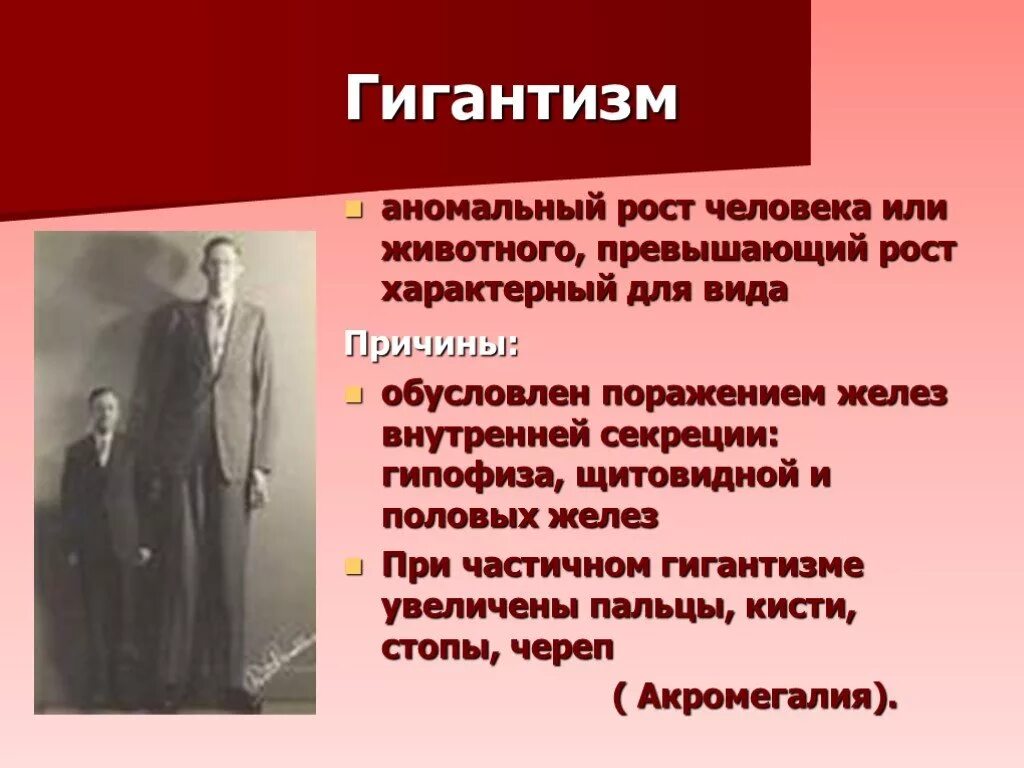 Признаки характеризующие рост. Признаки гигантизма. Гигантизм причины. Гигантизм презентация. Причины заболевания гигантизм.