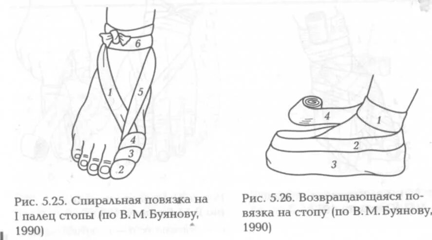 Наложение повязки на культю алгоритм. Колосовидная повязка на стопу алгоритм. повязка на культю алгоритм. спиральная повязка на 1 палец стопы. спиральная повязка на нижнюю конечность.