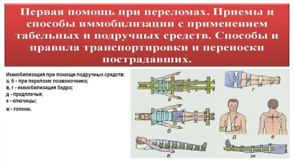 Транспортная иммобилизация при переломах конечностей. При переломе позвоночника. Первая помощь при Поломе позвоночника.