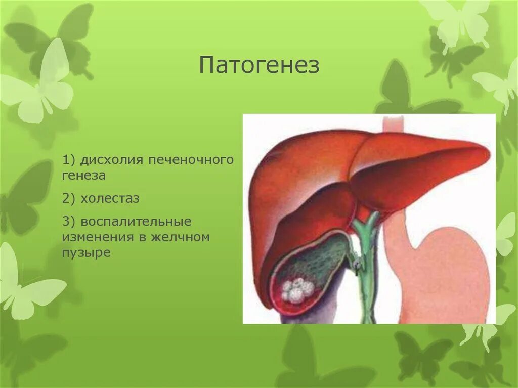 Дисхолия желчного. Дисхолия желчного пузыря что это такое. Дисхалегя желчного пузыря. Этиология заболеваний желчного пузыря.