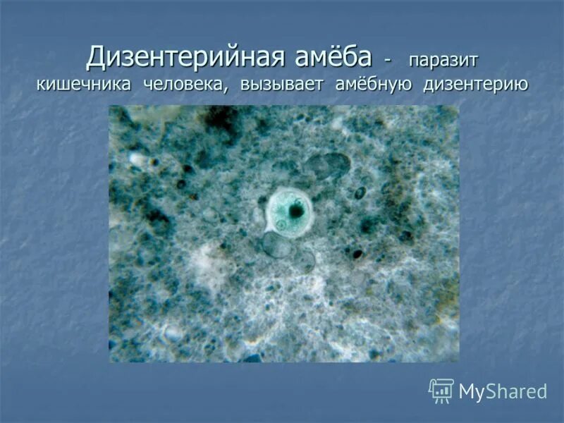 класс корненожки общая характеристика. амеба паразит или нет. амеба паразит или нет. амеба одноклеточная. амеба паразит или нет.