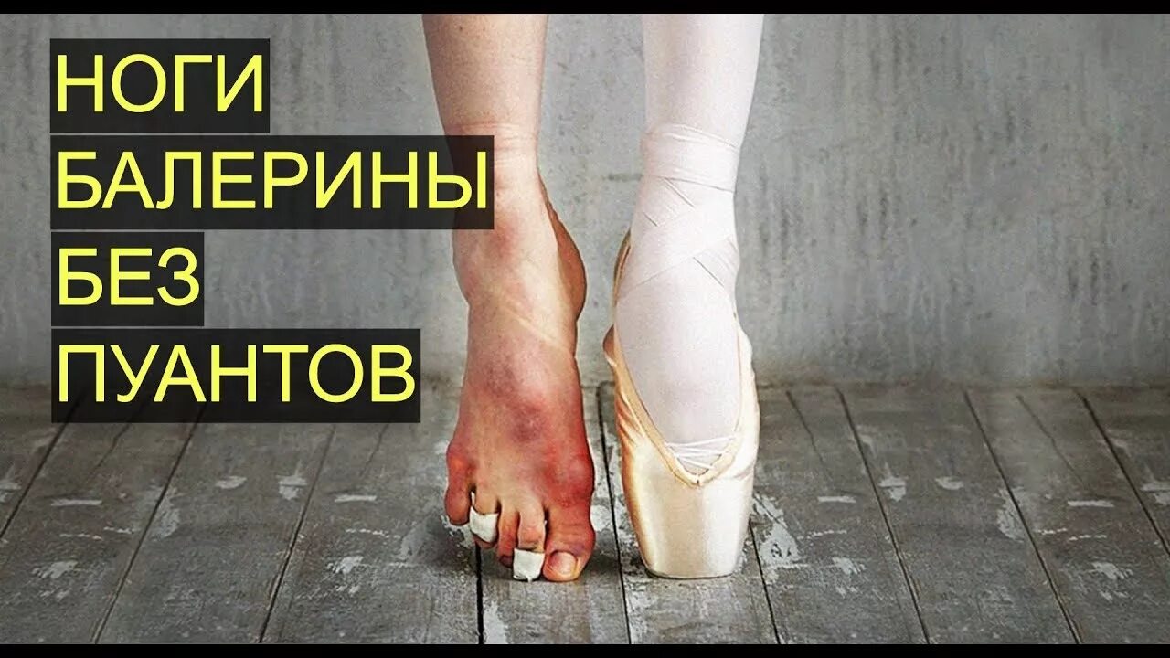 Как выглядит нога балерины в пуантах Как выглядит нога балерины в пуантах