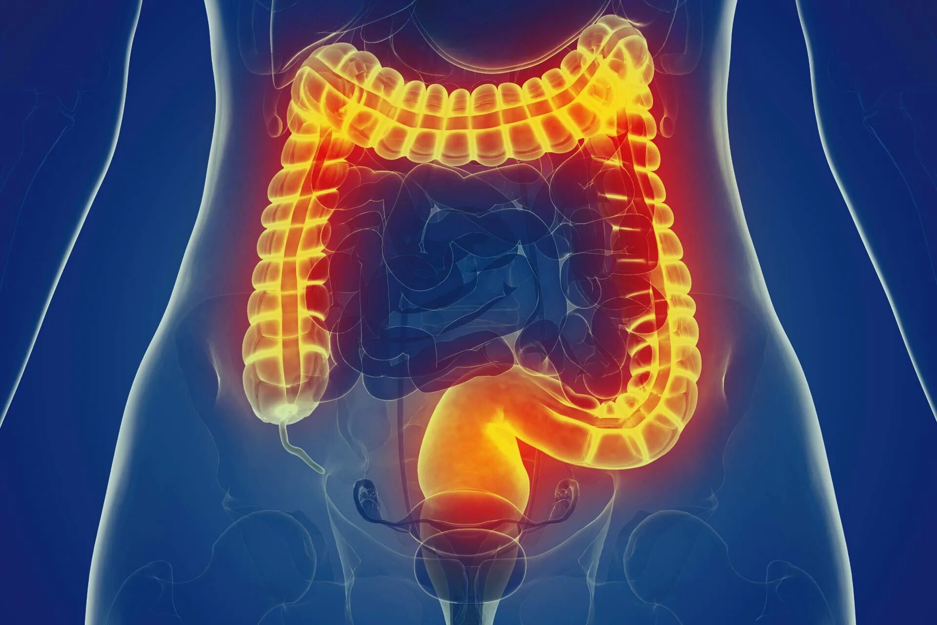 Bowel disease. Воспалительные заболевания кишечника. Язвенно некротический колит. Bowel disease. Пищеварение абстракция.