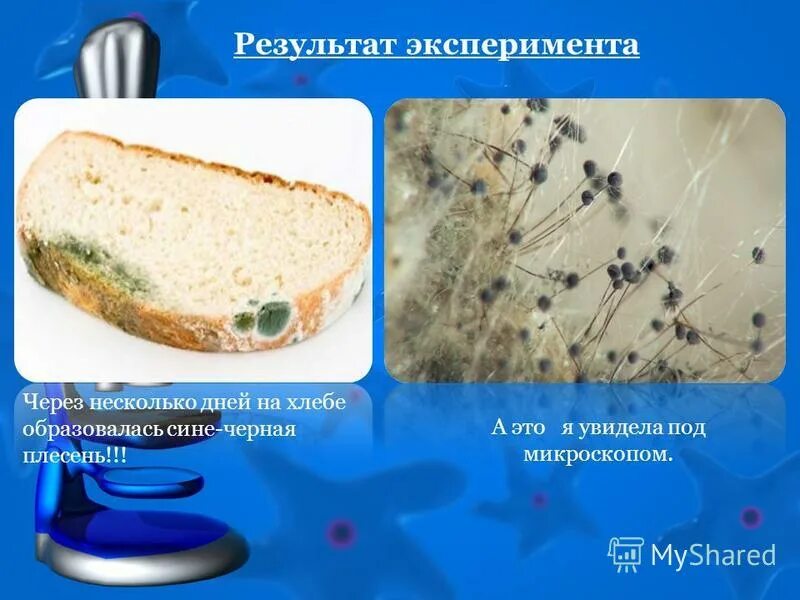 Плесневые грибы часто появляются на хлебе. Плесень на хлебе. Плесневые грибы. Плесневые грибы на хлебе. Плесневые грибы под микроскопом.