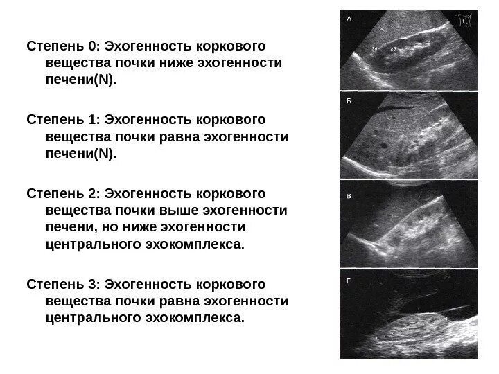 Печень диффузно неоднородная что это. Диффузное уплотнение ЧЛС почек УЗИ. Эхогенность коркового слоя почки в норме. Уплотнение паренхимы почки УЗИ. Эхоструктура неоднородная УЗИ почек.