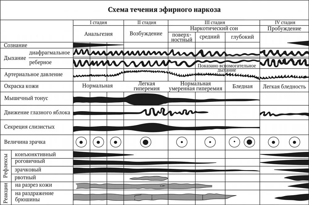 Схема стадий наркоза. Схема течения эфирного наркоза. Стадии течения эфирного наркоза. Стадии наркоза таблица. Стадии анестезии