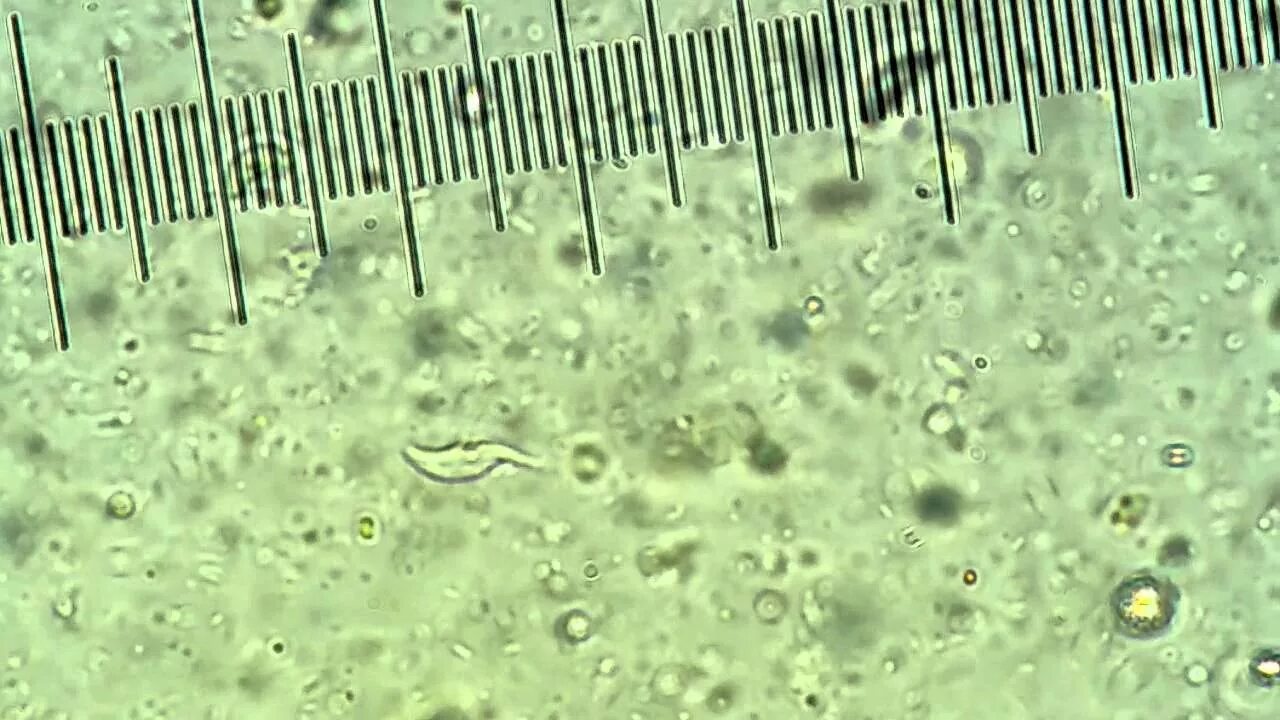 Как выглядит кал под микроскопом Medical Laboratory and Biomedical Science: Free Online Atlas of Human Parasitolo