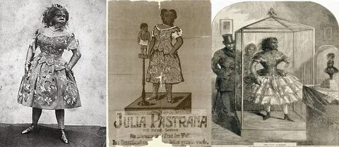 La historia de la mexicana Julia Pastrana, considerada.