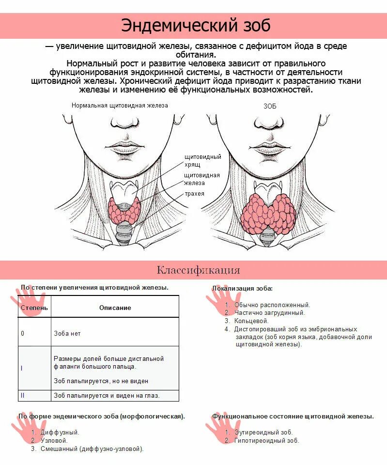Структурные изменения щитовидной. Памятки по профилактике заболеваний щитовидной железы. Основной клинический признак эндемического зоба:. Эндокринная система эндемический зоб. Зоб щитовидной железы формы.