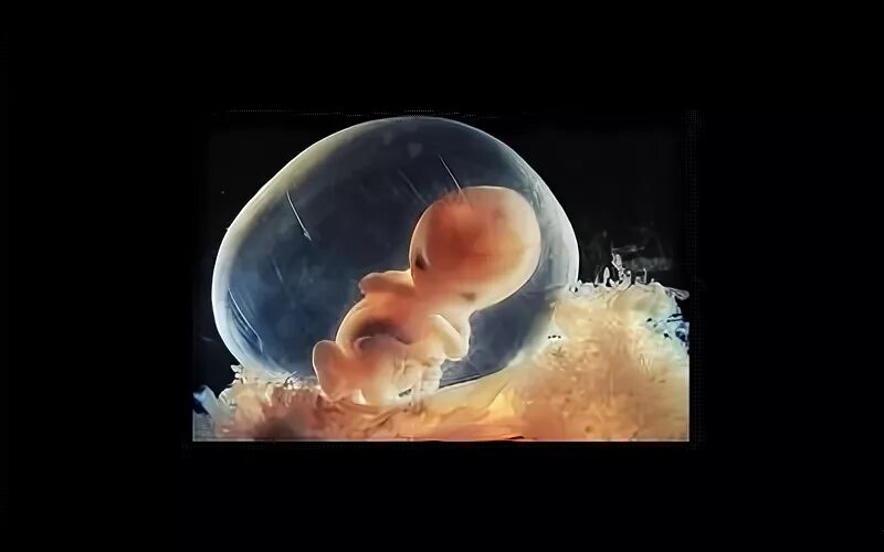 Эмбрионы человека Эрмитаж. Когда эмбрион становится плодом.