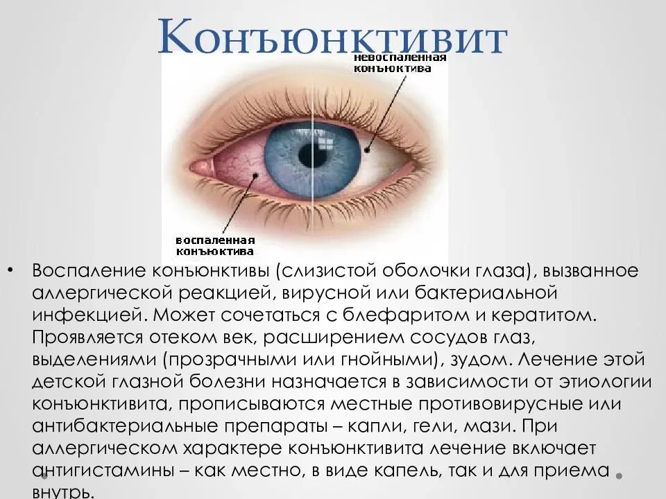 Симптом болят глаза