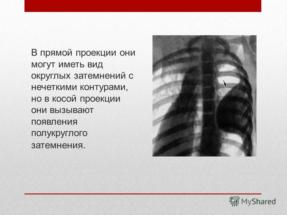 Как ты понимаешь что такое затемнение. Как ты понимаешь что такое затемнение