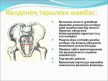 Кең жамбас фотолары бар үлкен есектер