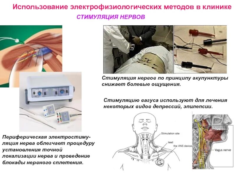 Стимуляция ощущения. Приборы стимуляции периферических нервов. электростимуляция нерва. электростимуляция периферических нервов. электрическая стимуляция нервов.