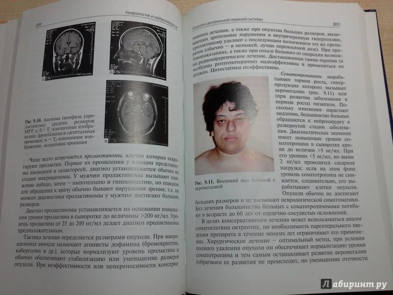 Книги по нейрохирургии. Неврология книги. Мозг нейрохирургия книга. Неврология и нейрохирургия Гусев.