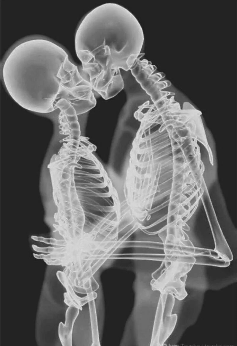 Рентген. Рентген девушки. Рентгеновские снимки. Поцелуй рентген.