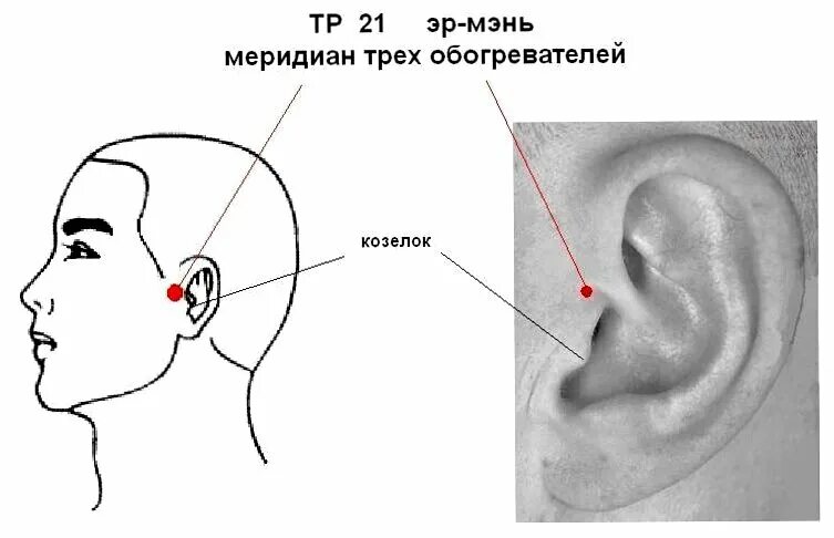 Точки шум в ушах. Точка Эр Мэнь. Точка Эр Мэнь от шума в ушах. Точка Тин-Хуэй от шума в ушах. Точка Эр-Мэнь расположение.