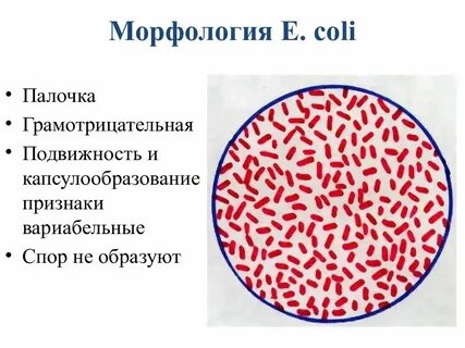 Нашли кишечную палочку