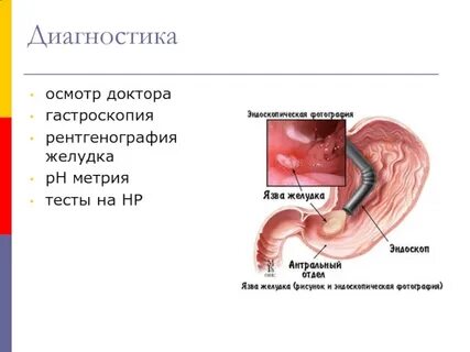 Эритематозная гастроскопия что это такое