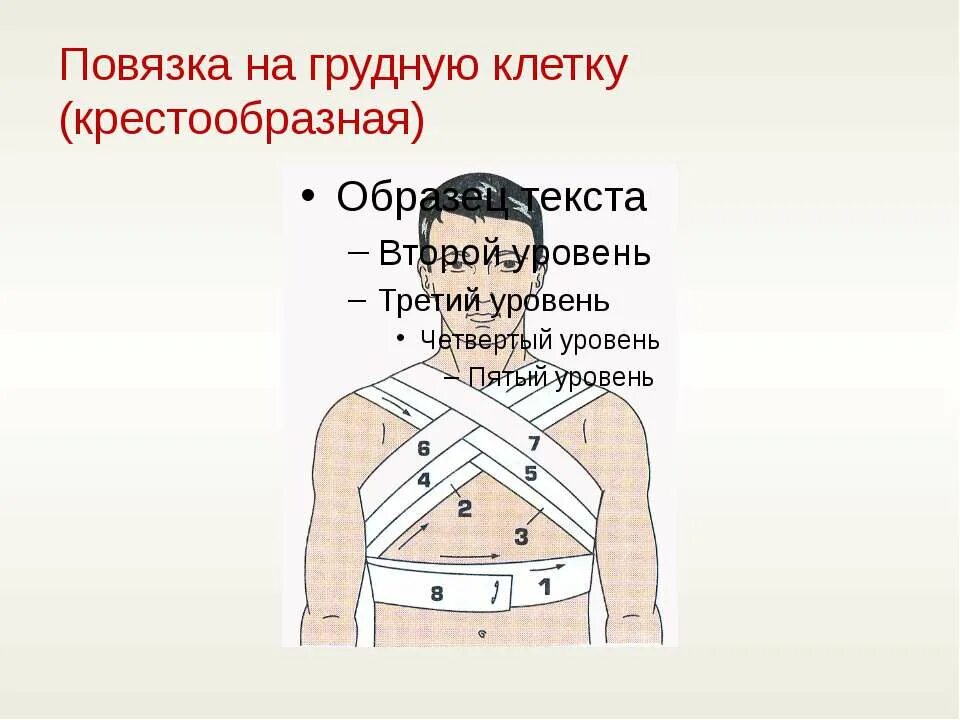 Повязка на грудную клетку алгоритм. Десмургия повязки на грудную клетку. Десмургия спиральная повязка на грудную клетку. Крестообразная на грудную клетку. Крестообразная повязка на грудь.