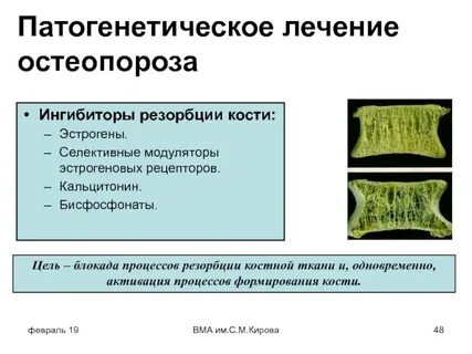 Остеопороз препараты какие