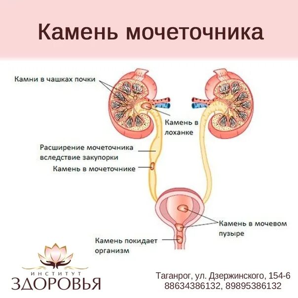 Мочеточники выходят из почки