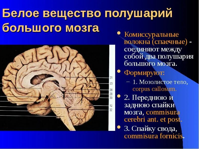 Спайки головного мозга. Комиссуральные волокна мозолистого тела. Белое вещество и мозолистое тело головного мозга. Строение свода конечного мозга. Спайки головного мозга свода.