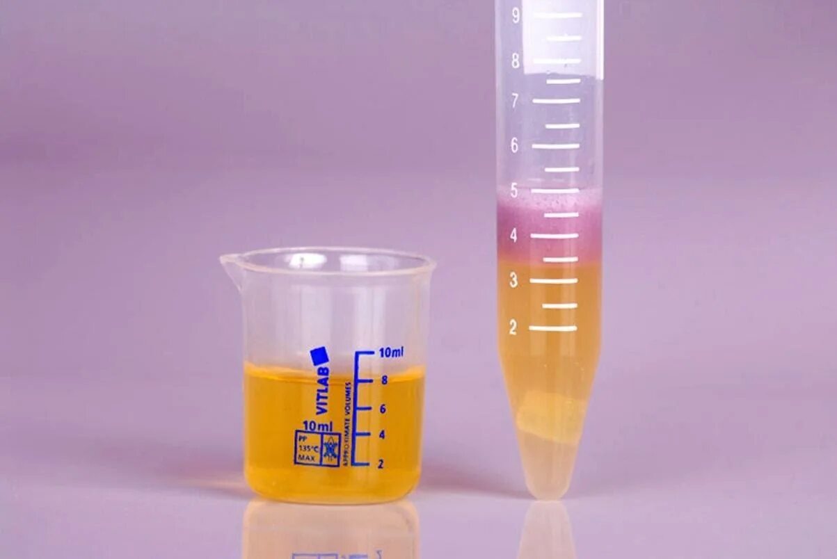Пробирка для мочи. Моча в пробирке. 50 Мл мочи. Осадки мочи в пробирках.