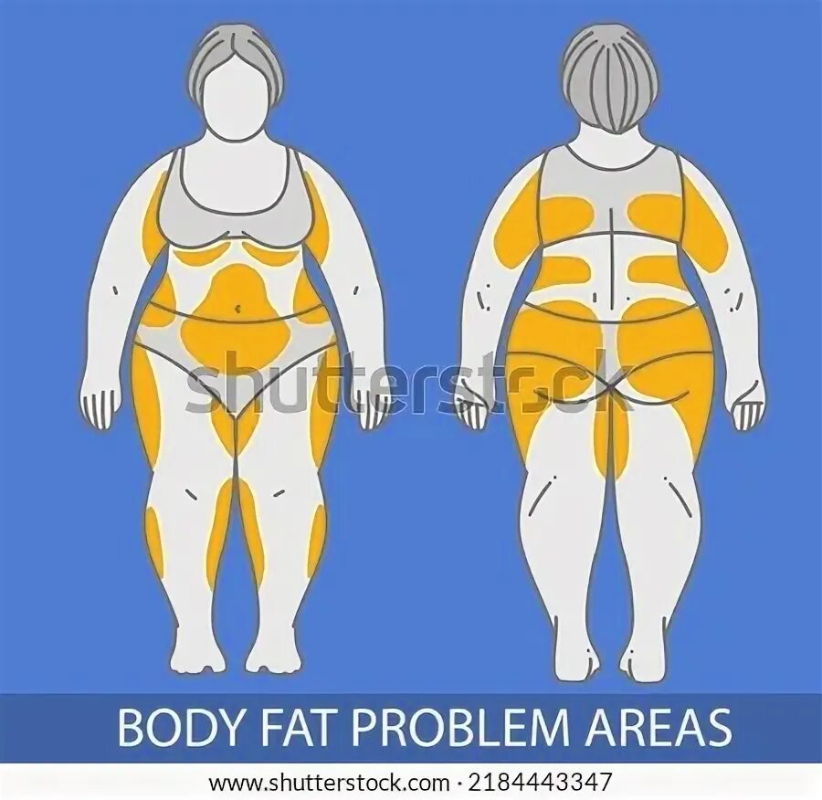 Problem areas. Fat's problem.