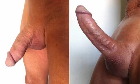 Pictures of erection 🔥 File:Circ Penis volle Erektion.jpg. 