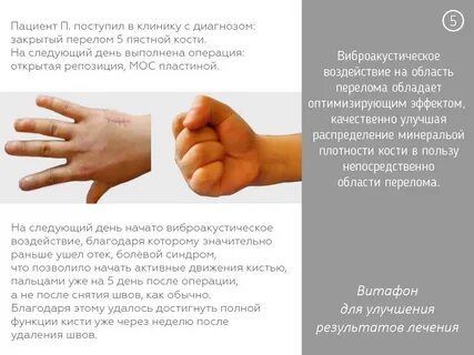 Витафон коленный сустав