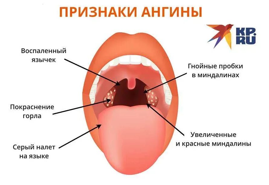 Температура пробка