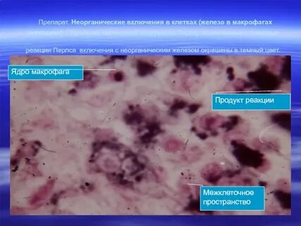 Макрофаги в щитовидной железе