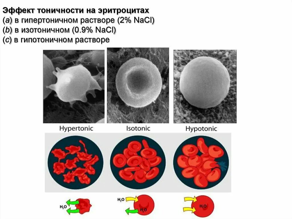 Эритроциты в растворе хлорида натрия. Эритроциты в изотоническом растворе. Эритроциты в гипотоническом растворе. Эритроцит в гипотоническом и гипертоническом растворе. Эритроциты в растворах разной концентрации.