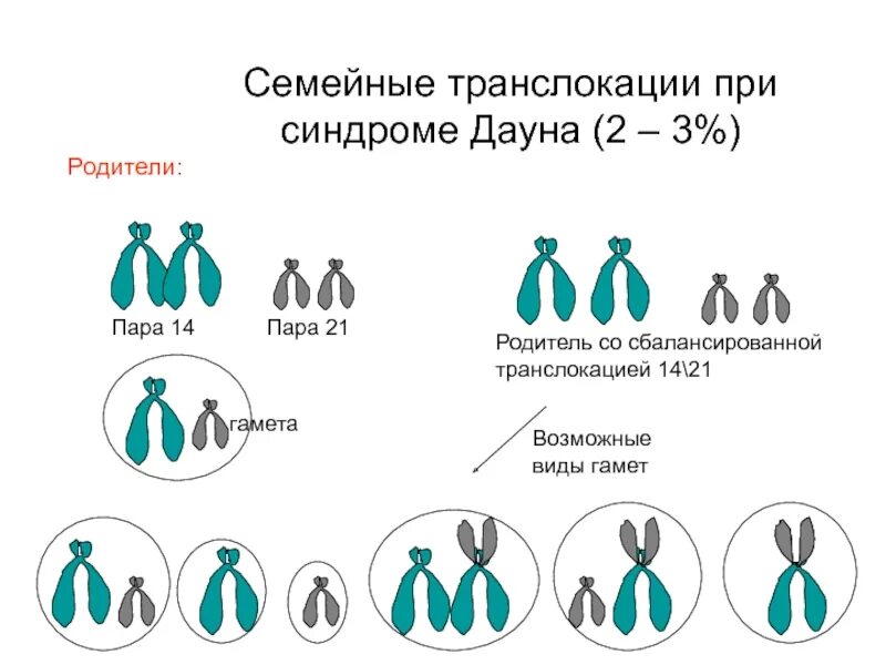 Кариотип транслокации. Транслокационная форма синдрома дауна. «синдром дауна» робертсоновские транслокации. транслокационная форма синдрома дауна кариотип. синдром дауна тип наследования.