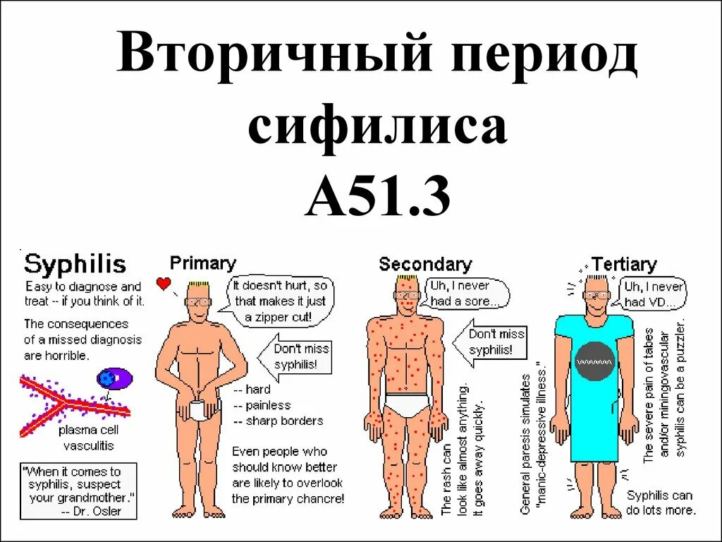 Вторичный фото. Вторичный сифилис проявления. Вторичный период сифилиса. Вторичный сифилис сроки. Признаки вторичного сифилиса.