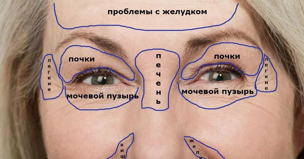 Проблемы лбом. Физиогномика межбровная складка. Прыщи на лбу между бровями.