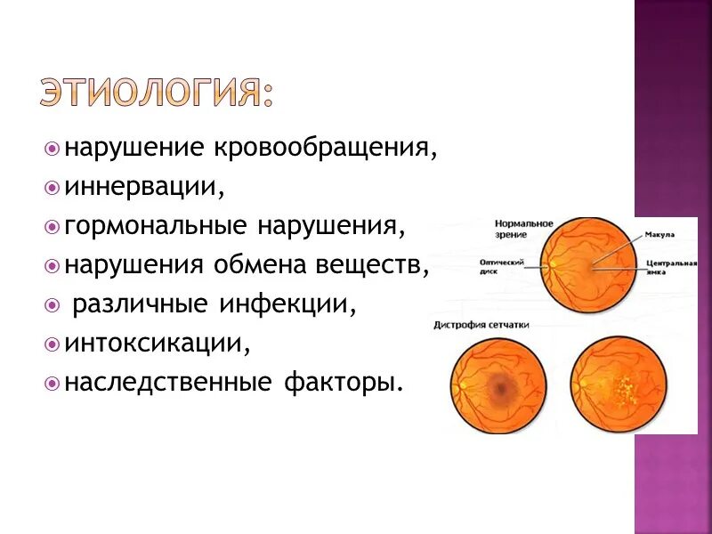 Периферические ретинальные дегенерации. Периферические дистрофии сетчатки классификация. Периферические дегенерации сетчатки презентация. Классификация дистрофий. Глаза. Наследственные дистрофии сетчатки классификация.