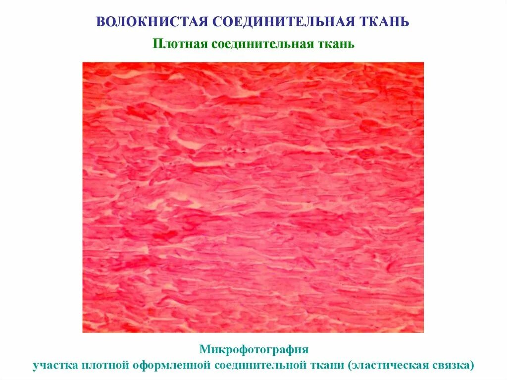 Плотная оформленная ткань. Плотная эластическая соединительная ткань. Эластическая волокнистая соединительная. Плотная волокнистая соединительная ткань эластического типа. Оформленная эластическая соединительная ткань.