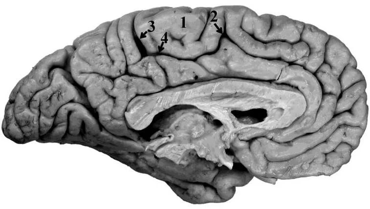 Восстановление коры мозга. Lobulus paracentralis. Архитектоника мозга. Архитектоника коры больших полушарий мозга. Поясная борозда.
