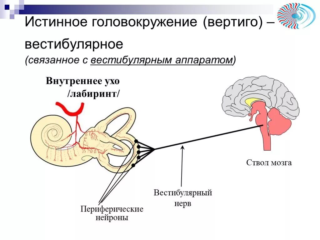 Причина вестибулярного аппарата. Истинное головокружение. Вестибулярные расстройства. Системное вестибулярное головокружение. Вертиго головокружение.