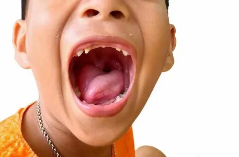Boy mouth
