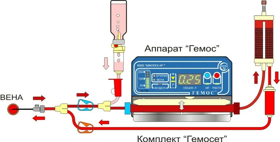 Гемос пф. Гемосорбция и плазмаферез. колонки для селективной гемосорбции.