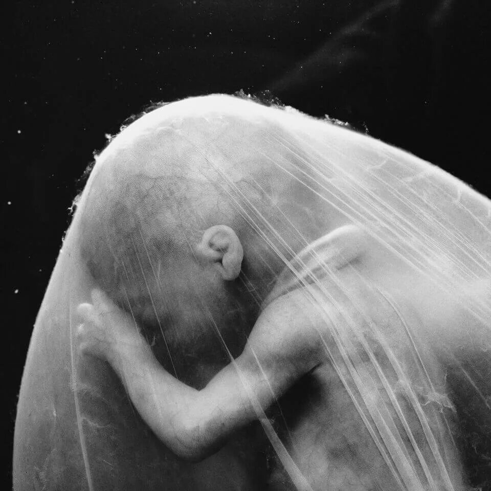Притча про младенцев в утробе. Леннарт Нильсон снимки в утробе. Эмбрион 18 недель Леннарт Нильссон 1965.