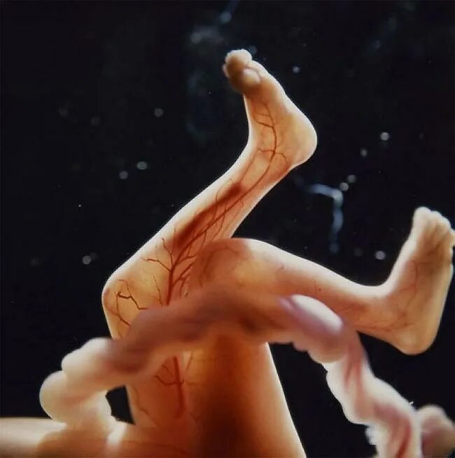 Эмбрион человека это. Эмбрион Леннарт Нильсон. Леннарт Нильсон снимки в утробе. Эмбрион 18 недель Леннарт Нильссон. Леннарт Нильсон Зарождение жизни фото.